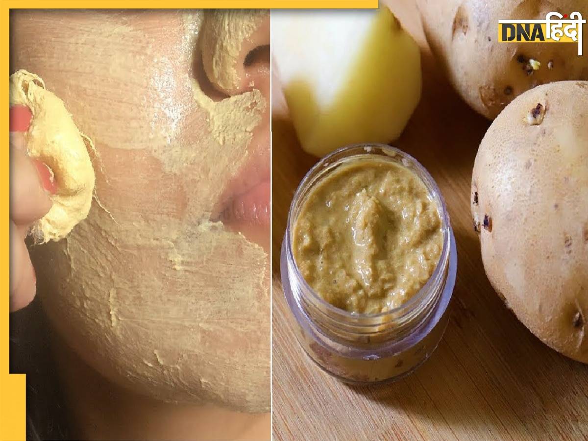 Potato Face Pack: चांद सा रोशन चेहरा चाहिए तो अपनाएं आलू से बने ये फेस पैक