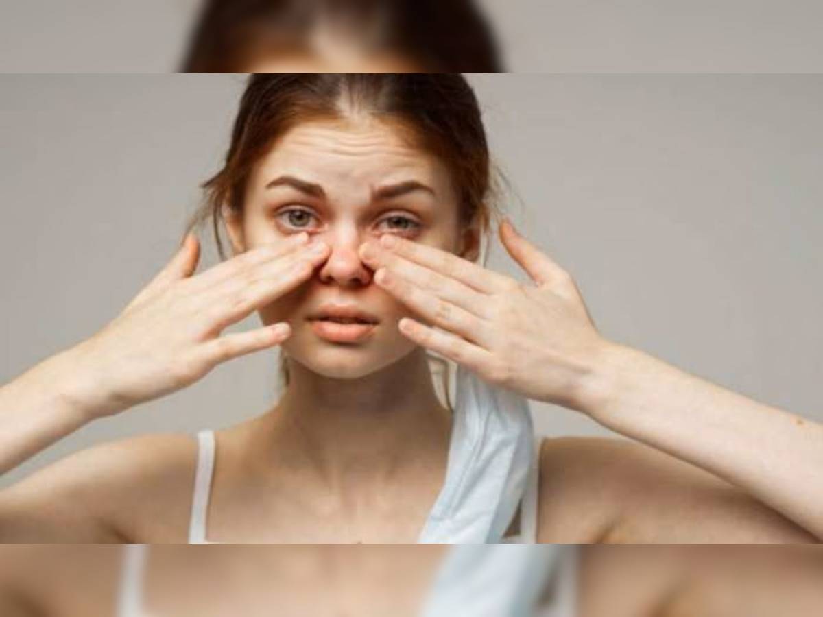 Eye Infection Remedy: आंखों में होने वाली खुजली हो सकती है खतरनाक, इन घरेलू नुस्खों से मिलेगा तुरंत आराम