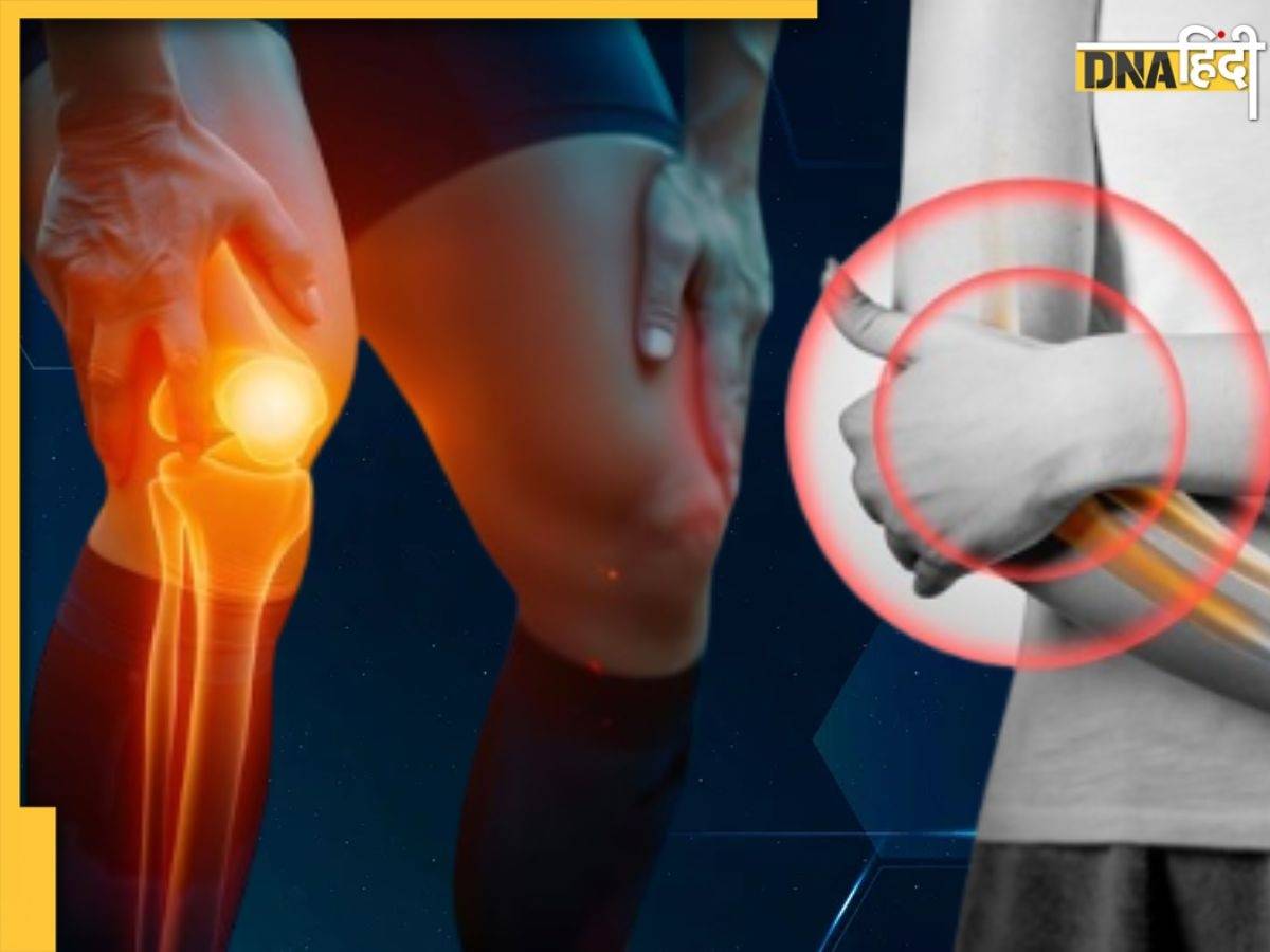 Joint Pain: हड्डियां हो रही हैं टेढ़ी, जोड़ों-घुटनों में रहता है भंयकर दर्द? कहीं इस बीमारी के लक्षण तो नहीं