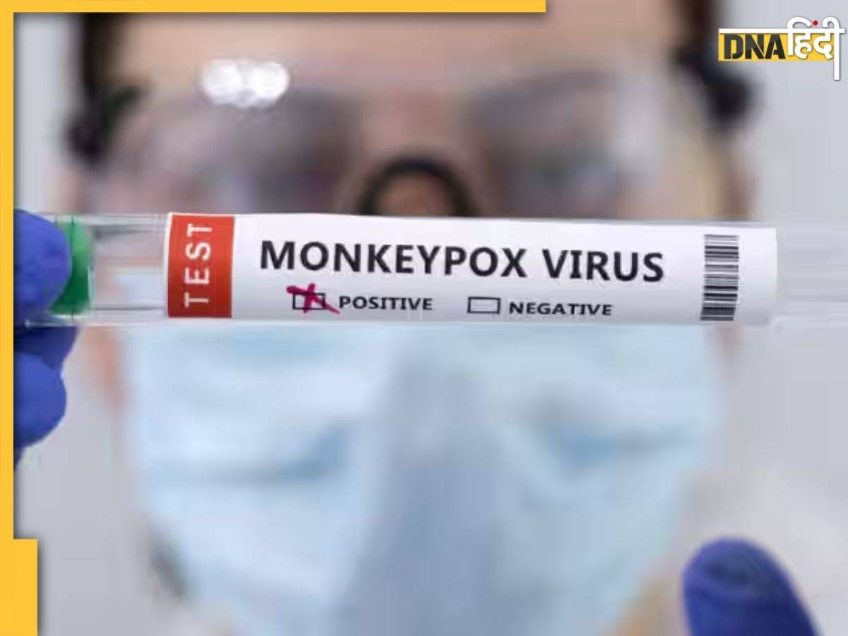 Corona जैसी महामारी बनी Mpox, 13 देशों में 14,000 केस, 542 मौत, WHO ने घोषित की ग्लोबल इमरजेंसी