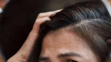 White Hair Remedy:20 की उम्र में ही इस विटामिन की कमी से सफेद हो जाते हैं बाल, 3 नुस्खें आजमाएं हो जाएंगे Black Hair