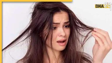 Dry Hair से हैं परेशान? बालों में इन चीजों के साथ मिलाकर लगाएं दही, हफ्ते भर में दिखने लगेंगे शायनी और सॉफ्ट 