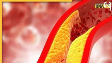 Cholesterol Home Remedy: किचन में मौजूद पीले और काले मसाले का जोड़ खोल देगा बंद नसें, खत्म हो जाएगा Bad Cholesterol