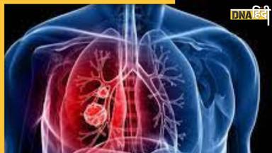 Lungs Cleaning Foods: फेफड़ों का कचरा निकाल देंगी ये 5 सस्ती चीजें, छनकर आएगी हर सांस