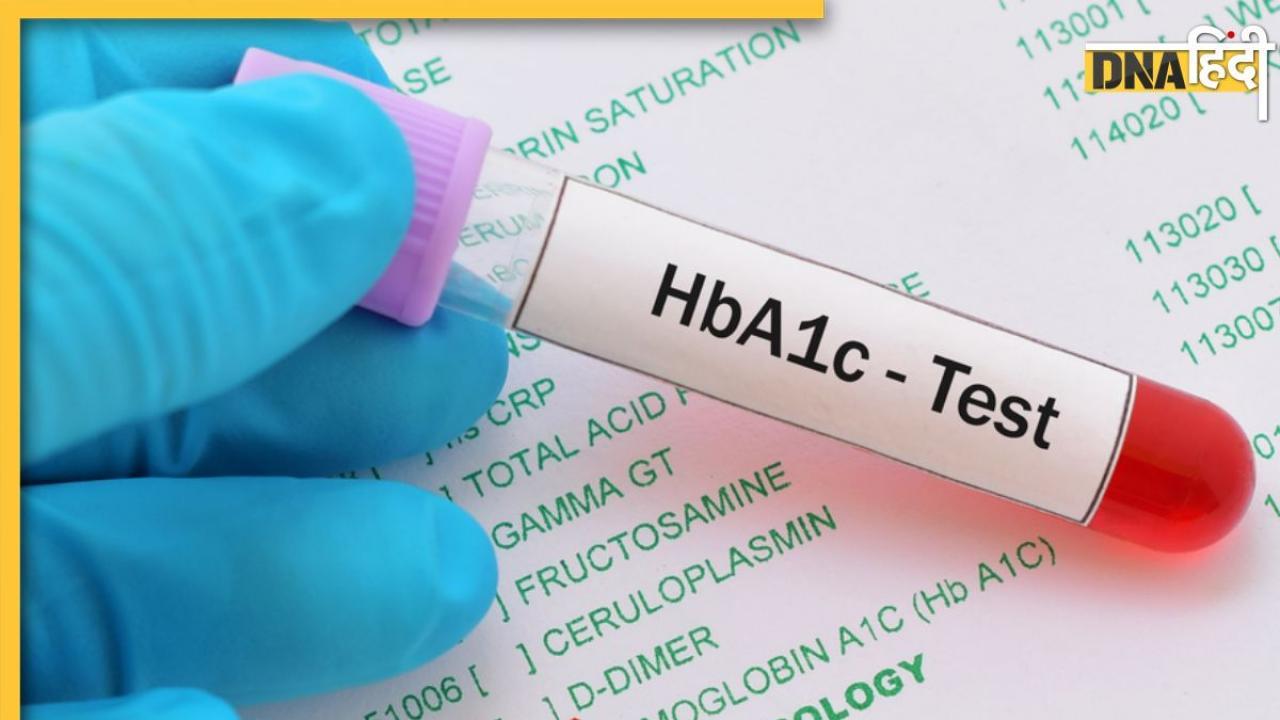 Diabetes Test: डायबिटीज मरीजों को हर 3 महीने में जरूर कराना चाहिए ये टेस्ट, लापरवाही बढ़ा सकती है खतरा  