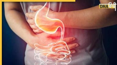 Worst Foods for Gut Health: आंतों के लिए जहर हैं ये 5 फूड, नहीं छोड़ेंगे खाना तो लगाने पड़ जाएंगे अस्पताल के चक्कर