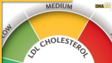 Superfoods For Bad Cholesterol: नसों में जमा बैड कोलेस्ट्राॅल को सूखा देंगे ये 10 सुपरफूड्स, बंद धमनियों में भी दौड़ने लगेगा खून