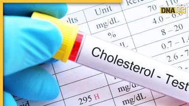 Cholesterol Test: ये टेस्ट खोल देगा नसों में जमा बैड कोलेस्ट्राॅल का राज, हार्ट अटैक से बचने के लिए जरूर कराएं चेक