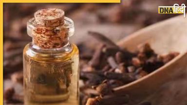 Clove oil Benefits For Skin: चेहरे पर निखार लाता है लौंग का तेल, इस तरह लगाएंगे तो एक्ने और पिंपल्स से मिलेगा छुटकारा