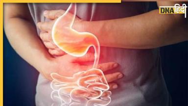 How To Detox Colon: आंतों में फंसी गंदगी को निकाल बाहर करेंगे ये 5 नेचुरल नुस्खे, नहीं होगी पेट से जुड़ी बीमारियां