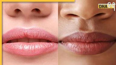 Dry Lips Causes: स्मोकिंग ही नहीं, होंठ काले होने के पीछे हैं ये 4 बड़ी वजह, न बरतें लापरवाही