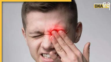 Eye Flu से जा सकती है आंखों की रोशनी, एक्सपर्ट्स से जानें इसकी वजह और इलाज