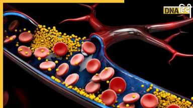 Cholesterol Control: 5 टेस्टी ड्रिंक्स हाई कोलेस्ट्रॉल को कर देंगे कंट्रोल, फैट फ्री होंगे नसें