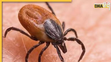 Scrub Typhus: एक छोटा सा कीड़ा ले रहा लोगों की जान, अब तक 14 की मौत, सैकड़ों बीमार