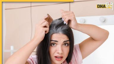 White Hair Remedies: सफेद बालों की छुट्टी कर देगा सरसों के तेल का ये देसी उपाय, जिंदगी भर काले और मजबूत रहेंगे बाल