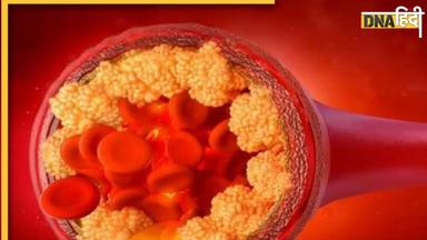 Cholesterol Control: कोलेस्ट्रॉल कम करने के लिए कभी ज्यादा न लें ये एक चीज, किडनी खराब होने का बढ़ेगा खतरा