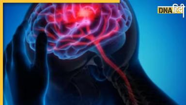 World Stroke Day 2023: ये 4 आसान एक्टिविटीज स्ट्रोक से रिकवरी में करेंगे मदद, याददाश्त भी होगी तेज 