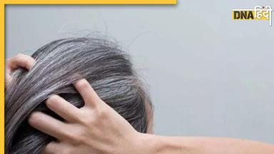 White Hair Remedies: सफेद बालों को काला कर देंगी रसोई में रखी ये 3 चीजें, जान लें इस्तेमाल करने का तरीका