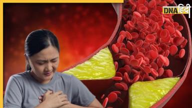 Cholesterol Remedy: कोलेस्ट्रॉल में रामबाण दवा का काम करते हैं ये 3 घरेलू नुस्खे, दवा की नहीं पडे़गी जरूरत