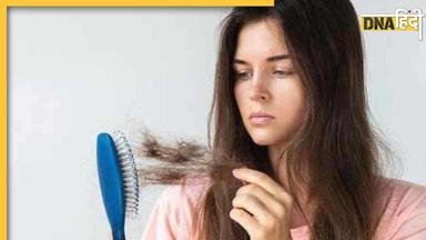 Hair Fall Control: हेयर फॉल रोकने के लिए पीएं ये आयुर्वेदिक चाय, झड़ते बालों की समस्या से मिलेगी राहत