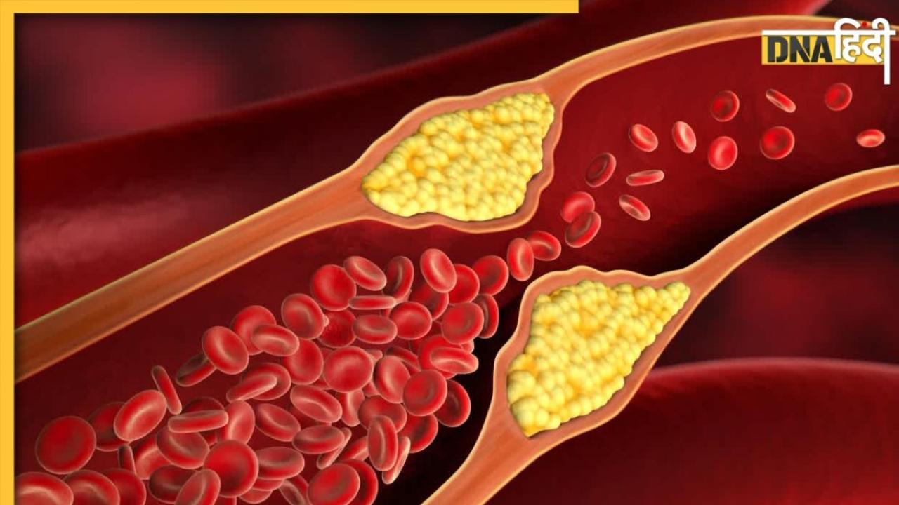 Cholesterol Control: नसों में जमा कोलेस्ट्रॉल खींच-खींच कर बाहर कर देंगे ये ड्राई फ्रूट्स और हर्ब्स, हेल्दी रहेगा हार्ट