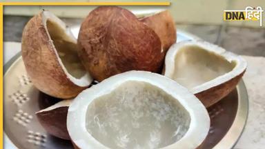 Dry Coconut: सूखे नारियल खाने के फायदे और नुकसान जान लें, डायबिटीज से लेकर कोलेस्ट्रॉल में खाएं या नहीं