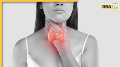 Thyroid Remedy: थायराइड मरीजों के लिए वरदान से कम नहीं हैं ये 5 चीजें, डायट में जरूर करें शामिल