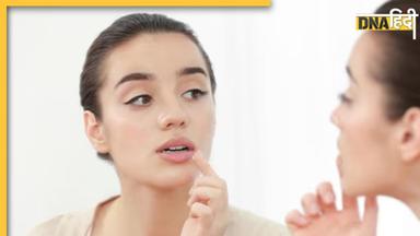 Lips Care Tips: अच्छे होंठों के लिए आजमाएं ये 5 टिप्स, सर्दियों में सूखे और फटे होंठों से मिलेगा छुटकारा