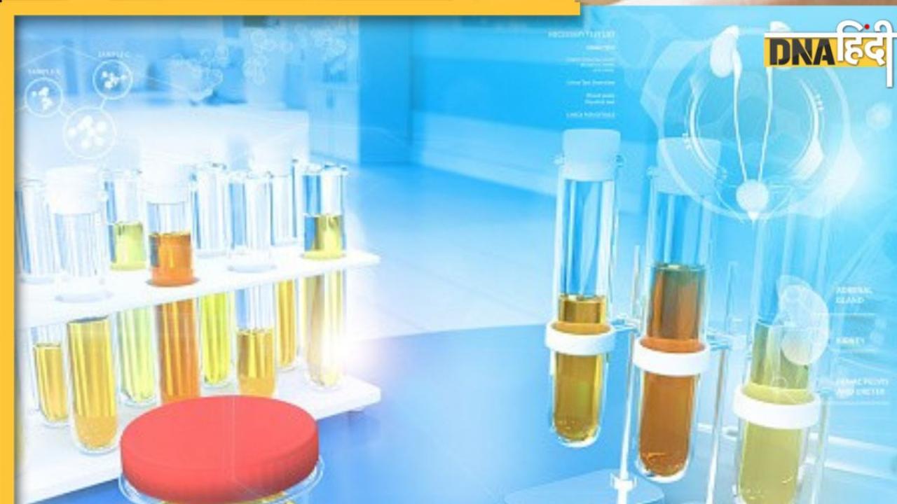 Urine Color: इन 3 रंग का पेशाब देता है किडनी की गंभीर खराबी का संकेत, डायबिटीज-हाई ब्लड प्रेशर वालों को खतरा ज्यादा