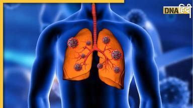 Lung Health: ये लक्षण बताते हैं कमजोर होने लगे हैं आपके फेफड़े, अनदेखा करने की न करें भूल