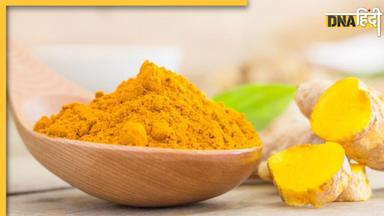 Turmeric Side Effects: पीलिया से पथरी तक, इन 5 बीमारियों से जूझ रहे लोगों को नहीं करना चाहिए हल्दी का सेवन