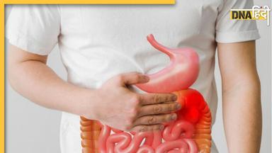 Stomach Problems: ब्लोटिंग, उल्टी समेत ये लक्षण पेट से जुड़ी इस गंभीर बीमारी का देते हैं संकेत, न करें अनदेखा