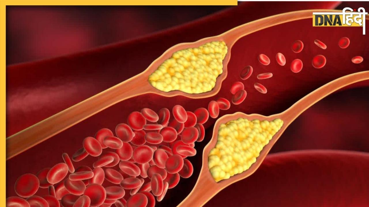 नसों में जमे Bad cholesterol को मोम की तरह पिघला देगी इस पेड़ की छाल, जानिए इसके अन्य लाभ