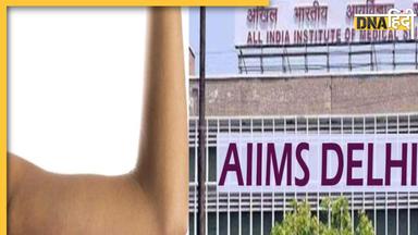 AIIMS News: घुटनों और कूल्हे की तरह अब AIIMS में होगा सस्ते में कोहनी का रिप्लेसमेंट