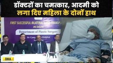 Hand Transplant In Delhi: ट्रेन हादसे में Painter के कटे हाथ, Doctors ने लगा दिए महिला के दोनों हाथ