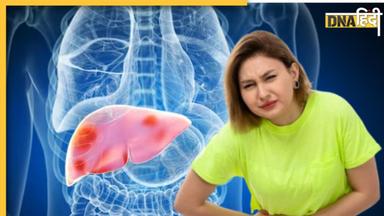 Fatty Liver Symptoms: फैटी लिवर होने पर चेहरे और गर्दन के पास दिखते हैं ये 4 लक्षण, इग्नोर करना पड़ेगा भारी