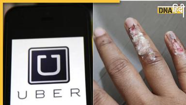 UBER ड्राइवर की लापरवाही के चलते हुआ 'Accident', महिला डॉक्टर ने किया कंपनी का 'Boycott', समझें पूरा मैटर