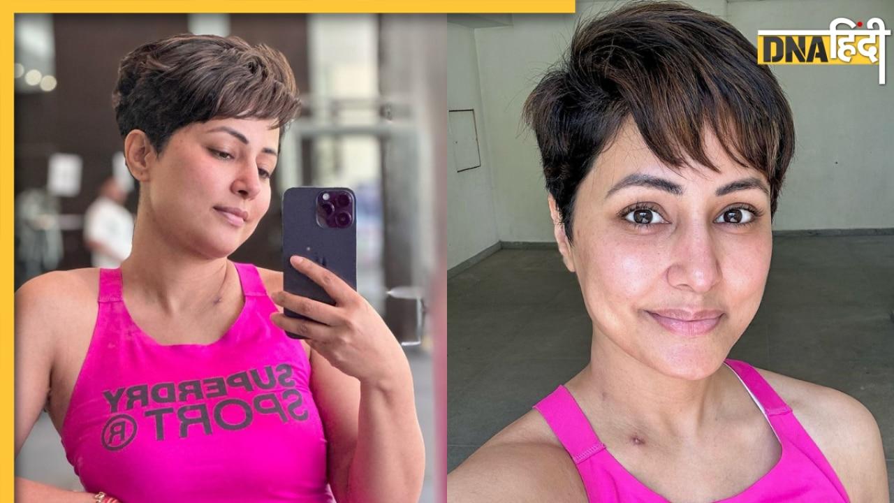 Hina Khan Update: बुरी हालत में नजर आईं हिना, फैंस का टूटा दिल