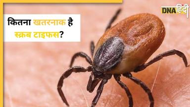 क्या है Scrub Typhus? शिमला में इस बीमारी से हुई पहली मौत ने बढ़ाई लोगों की चिंता