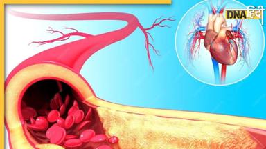 नसों में जमा Bad Cholesterol को बाहर कर देंगी रोजमर्रा की ये 5 आदतें, हेल्दी रहेगा हार्ट