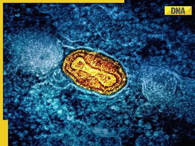 Monkeypox vs Chickenpox: Know 7 key differences