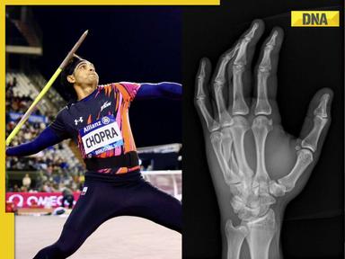 ‘I had fractured my....’: Neeraj Chopra's big Diamond League final revelation