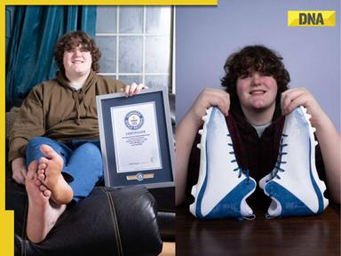 Meet teen who set Guinness World Record for largest hands, feet; they measure over…