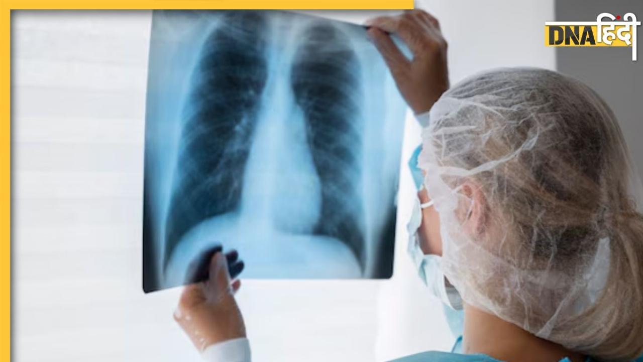 Lung Cancer Signs: बॉडी में दिखने वाले ये लक्षण देते हैं लंग्स कैंसर का संकेत, शुरुआत का पता लगते ही किया जा सकता है कंट्रोल