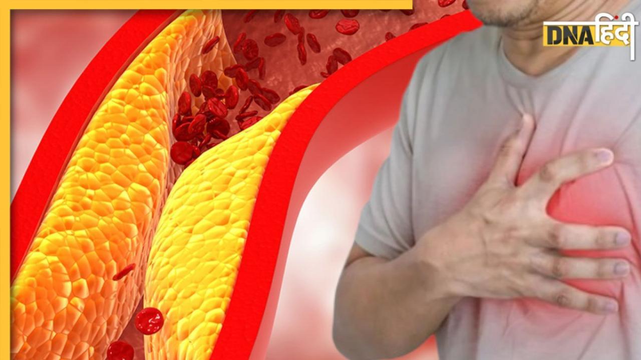 Bad Cholesterol को बाहर निकाल फेंकेगी किचन में मौजूद यह चीज, 5 तरीकों से करें सेवन